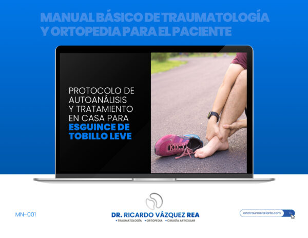 Manual para tratamiento de esguince tobillo.