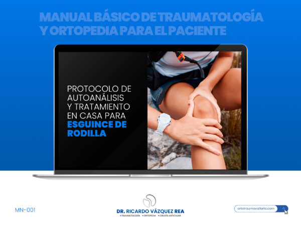 Manual para tratamiento de esguince de rodilla